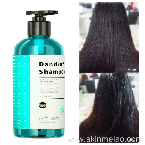 Nourishing Deep Cleansing Anti Dandruff Hair Shampoo